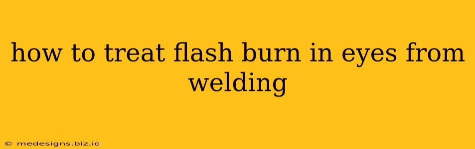 how to treat flash burn in eyes from welding